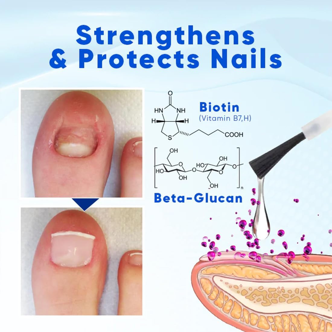 OnyxoGuard Nail Growth & Repair Serum - Nail Strengthener for Thin, Brittle & Damaged Nails - Polish Repair Essence & Base Coat Treatment - Perfect for Salon & Home Nail Care
