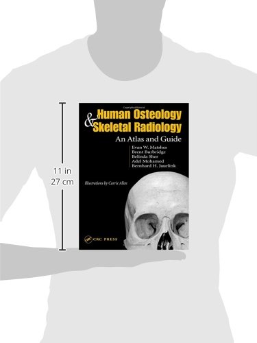 Human Osteology and Skeletal Radiology Atlas - Comprehensive Bone Structure Guide for Medical Students & Professionals | Ideal for Anatomy Study, Forensic Analysis & Clinical Diagnosis