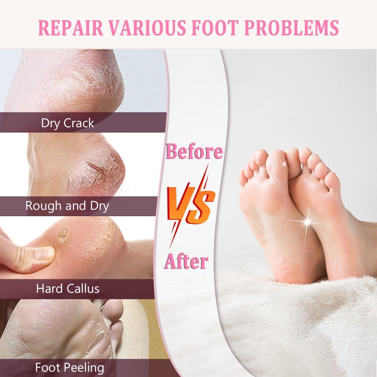 JOYHILL Moisturizing Gel Socks for Dry Cracked Feet - Heel Repair & Spa Care for Women/Men - Pink