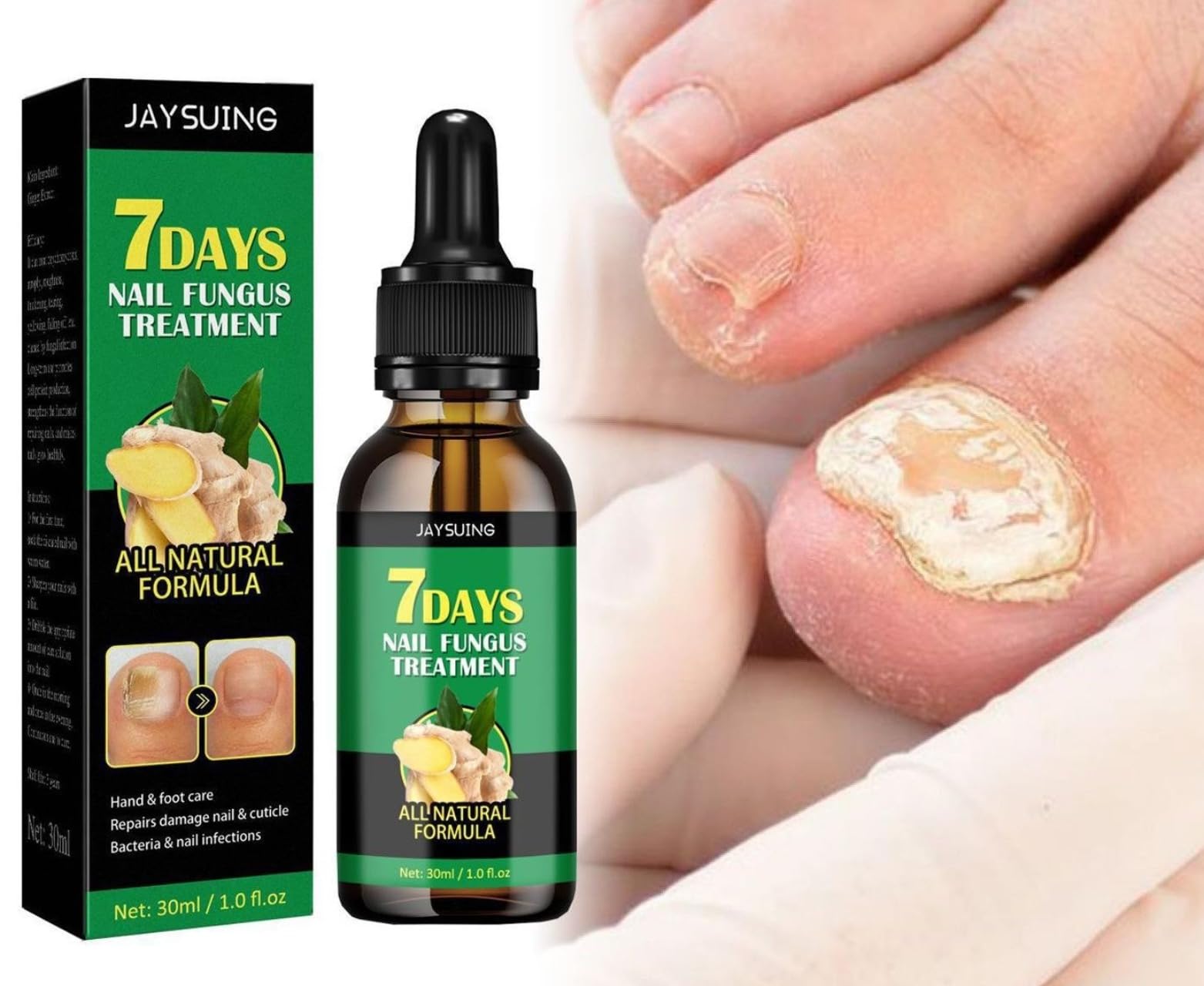 7-Day Ginger Nail Serum & Cuticle Care Oil - Natural Nail Treatment for Stronger Nails | Ginger Nail Support & Repair | Perfect for Dry, Brittle Nails & Cuticle Care | At-Home Manicures & Nail Spa Treatments