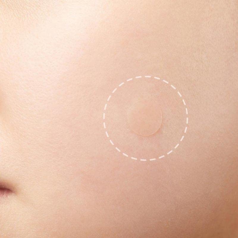 Mluffy 36Pcs Invisible Acne Pimple Patches - Hydrocolloid Spot Treatment Stickers for Face, Absorbing Blemish & Scar Care, Waterproof Transparent Pimple Patch Sheets for Clear Skin (Pack of 1) | Perfect for Overnight Spot Treatment, Teen & Adult Acne Care, Travel-Friendly Skin Solution