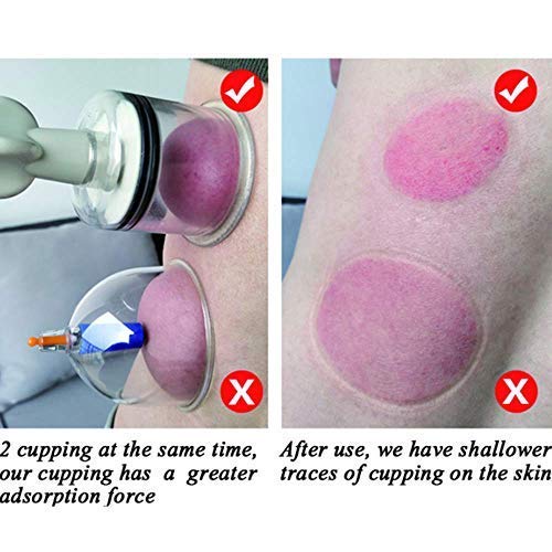 Premium Vacuum Cupping Therapy Set - 8 Piece Full Body Massage Kit for Pain Relief & Relaxation | Professional Cupping Massager with Twist Suction Technology | Ideal for Muscle Recovery, Stress Relief & Spa Treatments