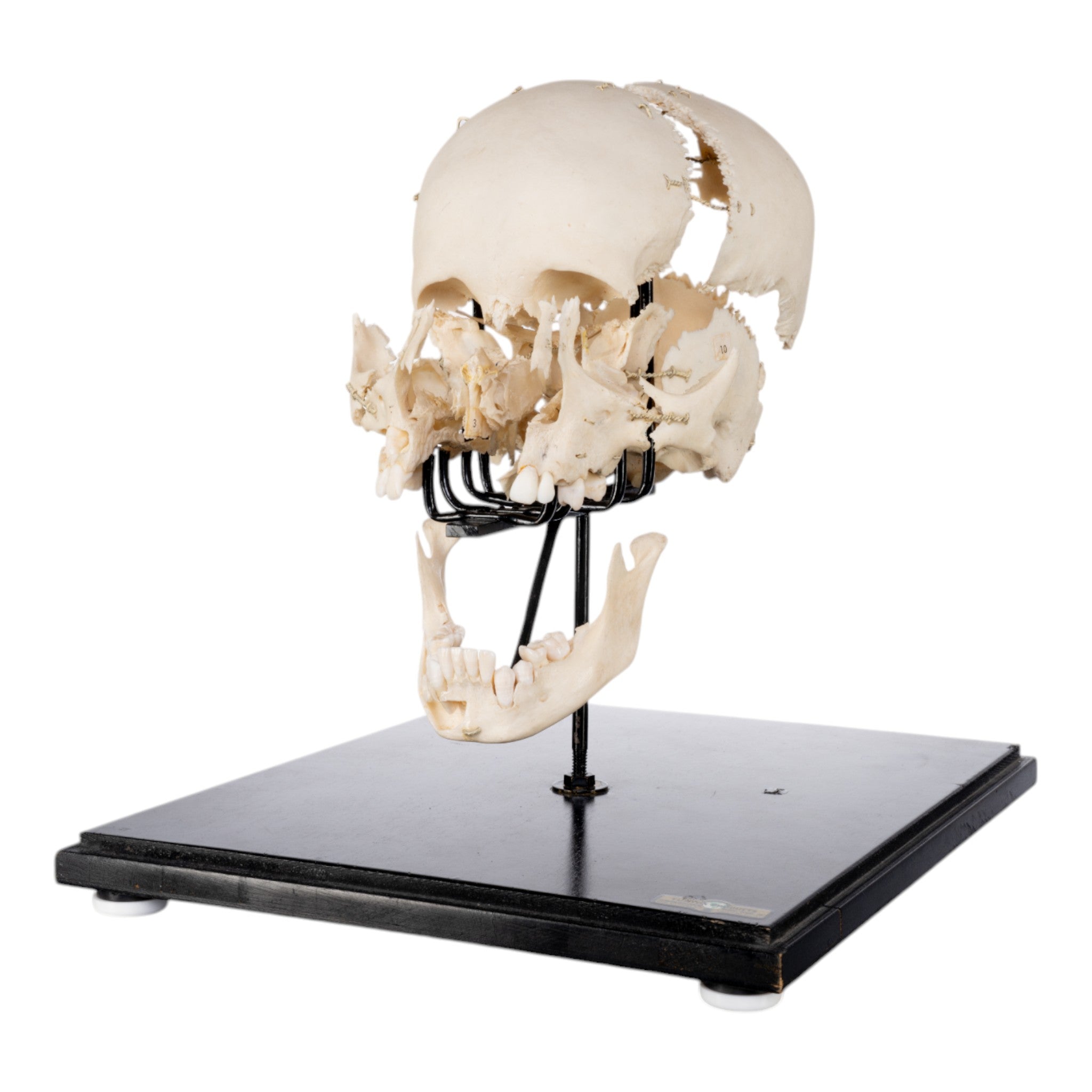 Real Human Exploded Skull Model on Display Stand - Perfect for Anatomy Study, Medical Education & Halloween Decor