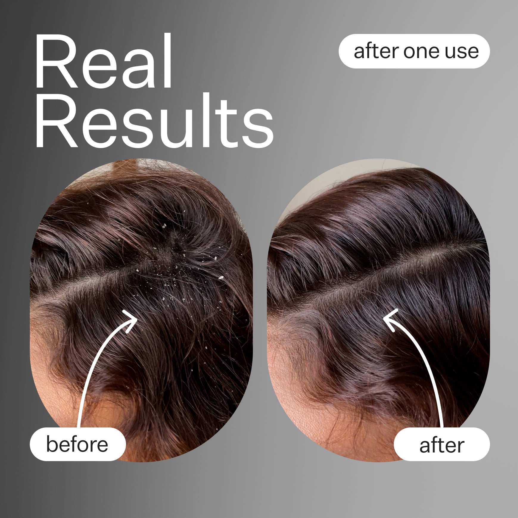 Scalp Renew Hair Growth Serum - Natural Scalp Treatment for Thicker, Healthier Hair - Perfect for Men & Women with Thinning Hair or Hair Loss - Use Daily for Best Results