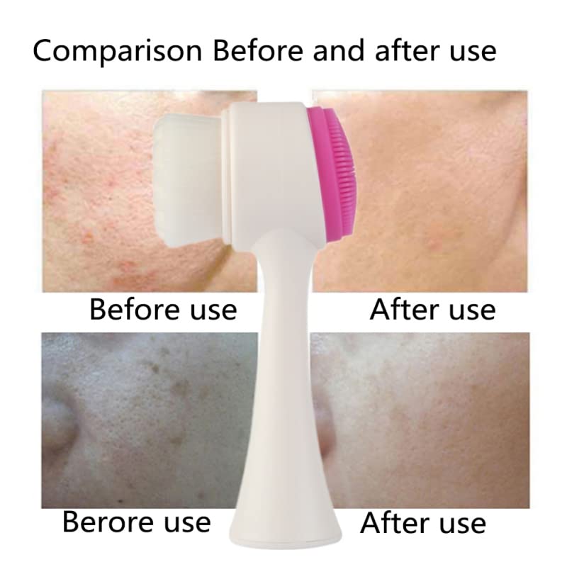 Premium Silicone Facial Cleansing Brush - Double Sided Exfoliating & Massaging Brush for Deep Pore Cleansing, Blackhead Removal & Makeup Removal | Ultra Soft Bristles for Sensitive Skin | Gentle Acne Treatment & Dead Skin Removal (Sky Blue) | Perfect for Daily Skincare Routine & Spa-Like Facial at Home