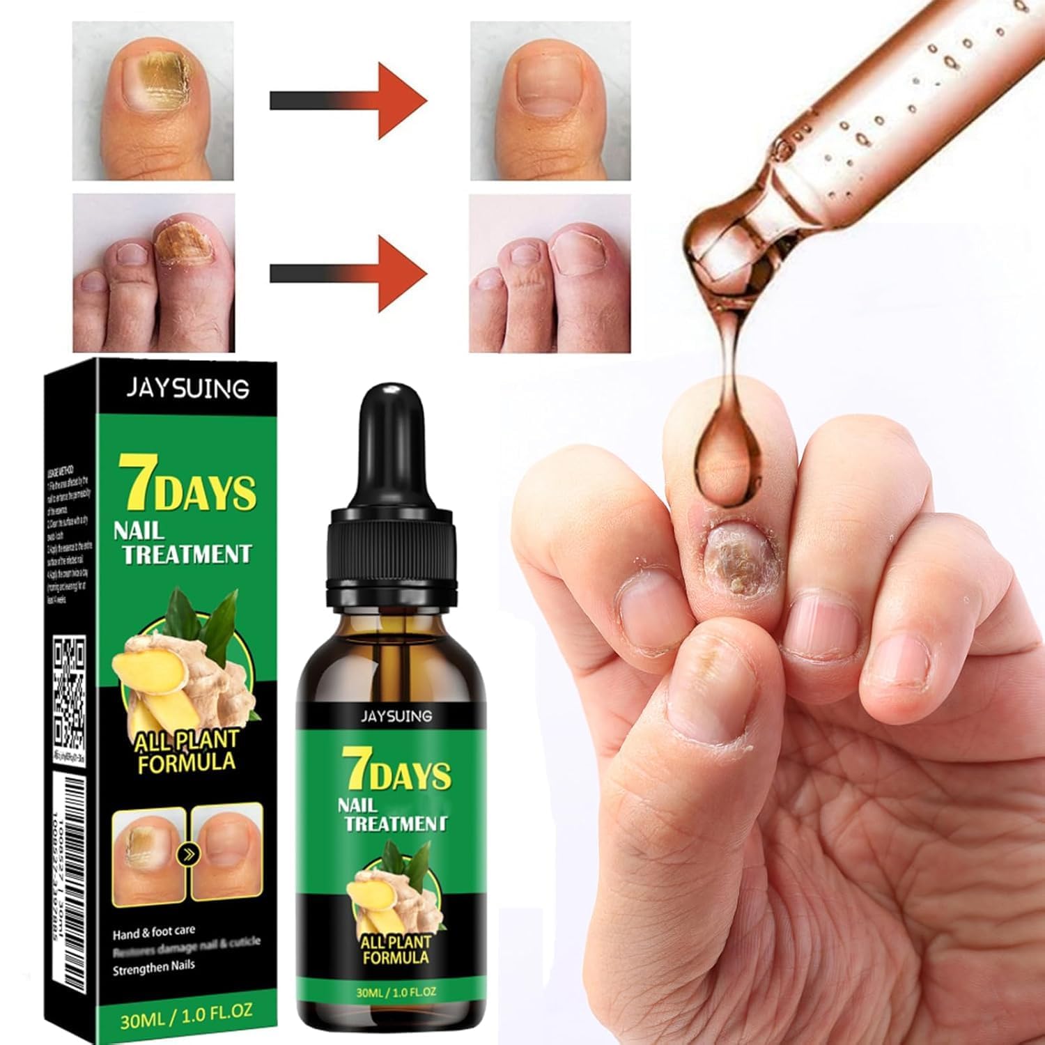 7 Days Nail Fungus Treatment - Ginger & Turmeric Nail Repair Serum for Damaged, Brittle & Peeling Nails | Fast Absorbing, Non-Greasy Cuticle Oil | Hydrating Nail Care Solution for Fungal Infections & Healthy Nails | Perfect for Daily Use at Home or Salon