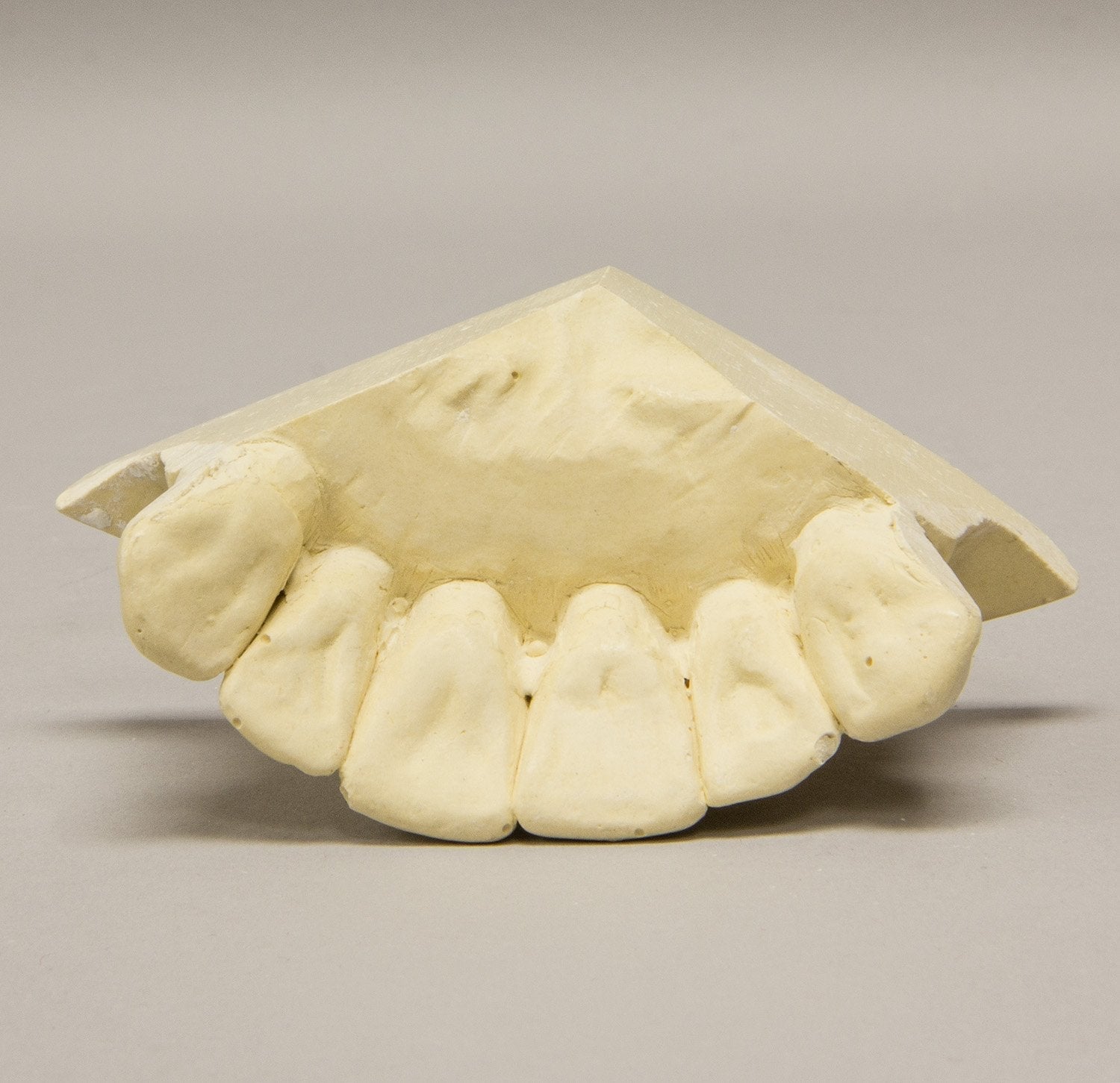 High-Quality Replica Orthodontic Study Model - Durable Dental Training Teeth for Students & Professionals | Perfect for Dental Schools, Clinics & Practice Sessions