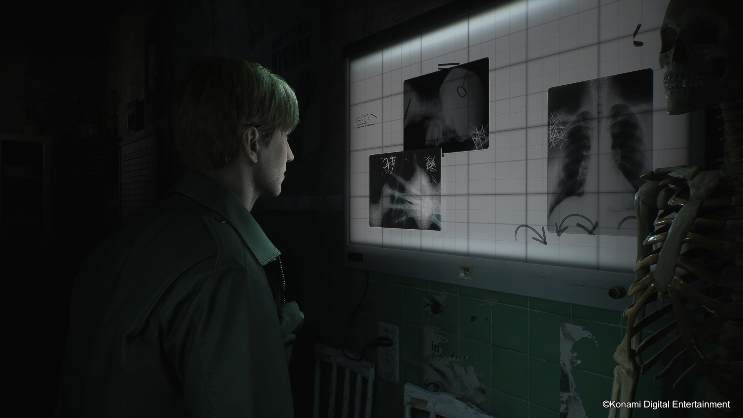 Silent Hill 2 PS5 Game - Psychological Horror Survival Game for PlayStation 5 - Perfect for Horror Game Fans & Nighttime Gaming Sessions