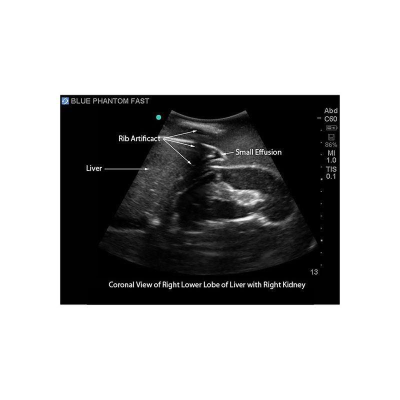 FAST Exam Ultrasound Training Model - Transthoracic & Transesophageal Echo Simulator for Cardiac Sonography Practice (Ideal for Medical Students, Ultrasound Tech Training & Clinical Skills Development)