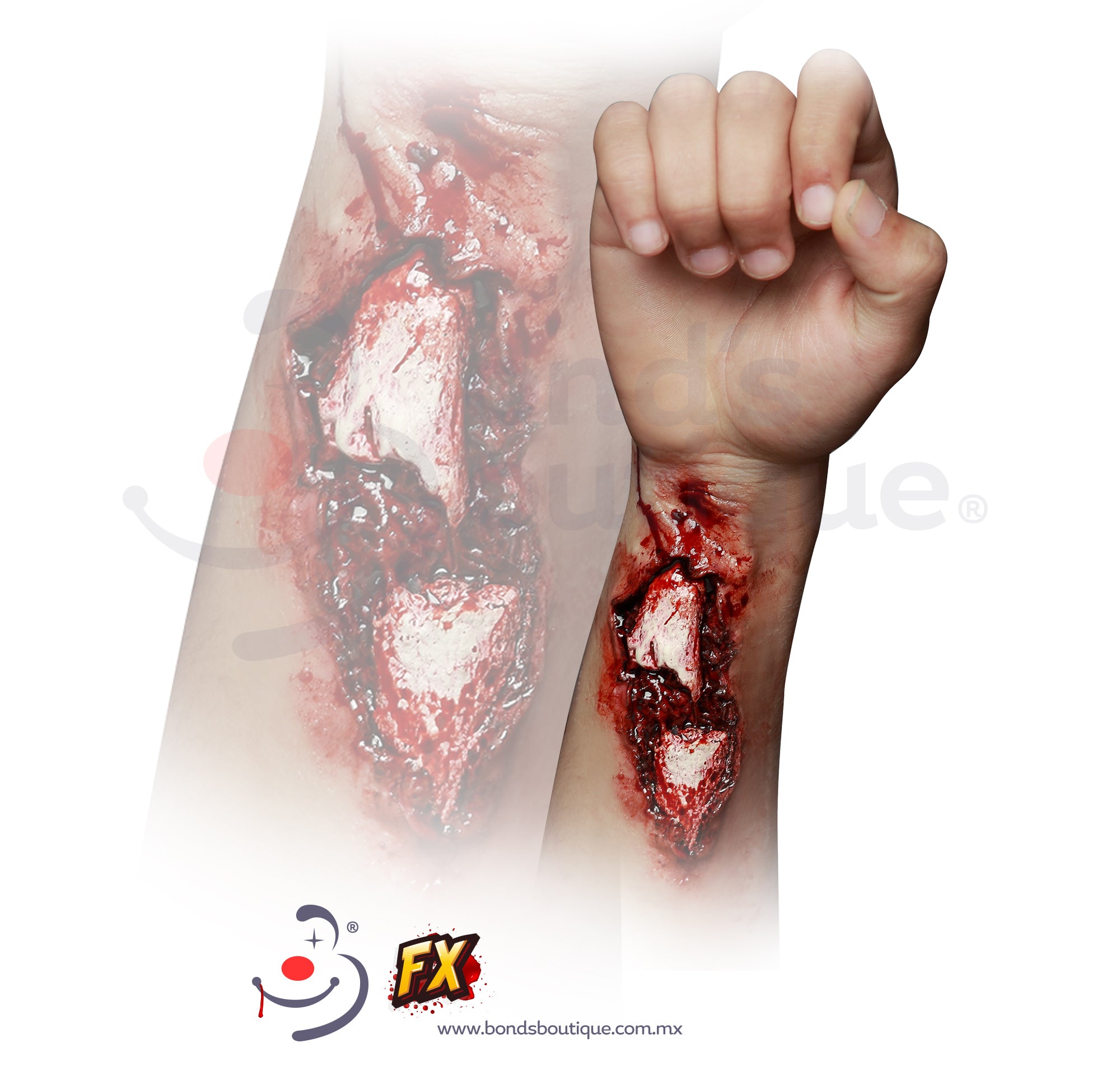 Broken Arm Sling - Adjustable & Comfortable Support for Arm Injuries | Ideal for Sports, Accidents & Post-Surgery Recovery