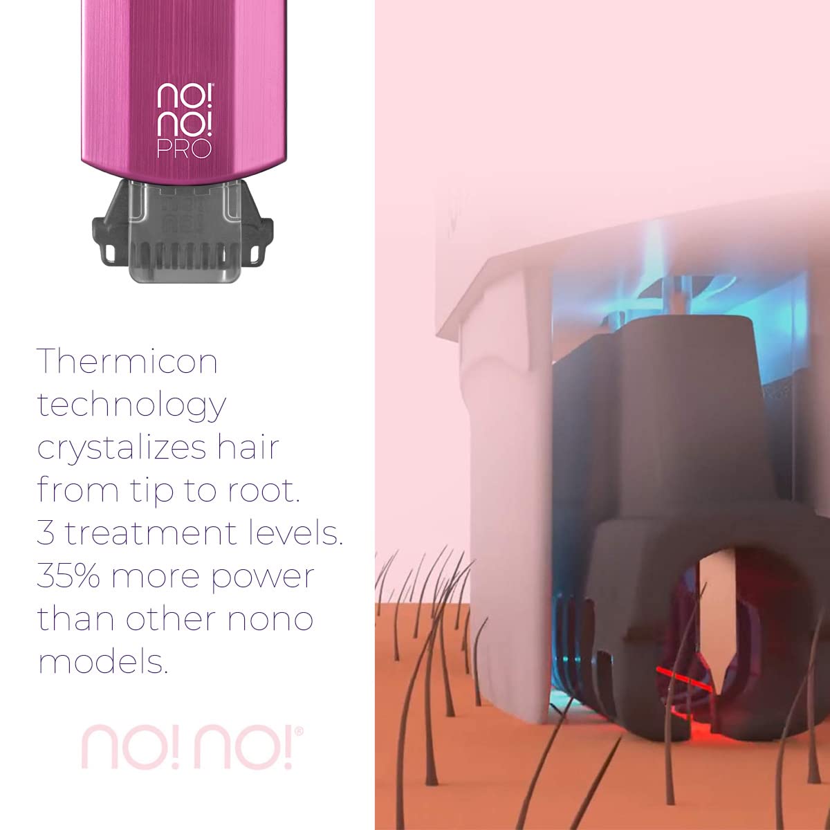NO!NO! Pro Hair Removal Device Basic Kit - Permanent Hair Removal System for Women & Men with Buffer & Tip Attachments - Painless Facial & Body Hair Remover (Pink) - At-Home Salon Smooth Skin Solution for Legs, Bikini Line & Underarms