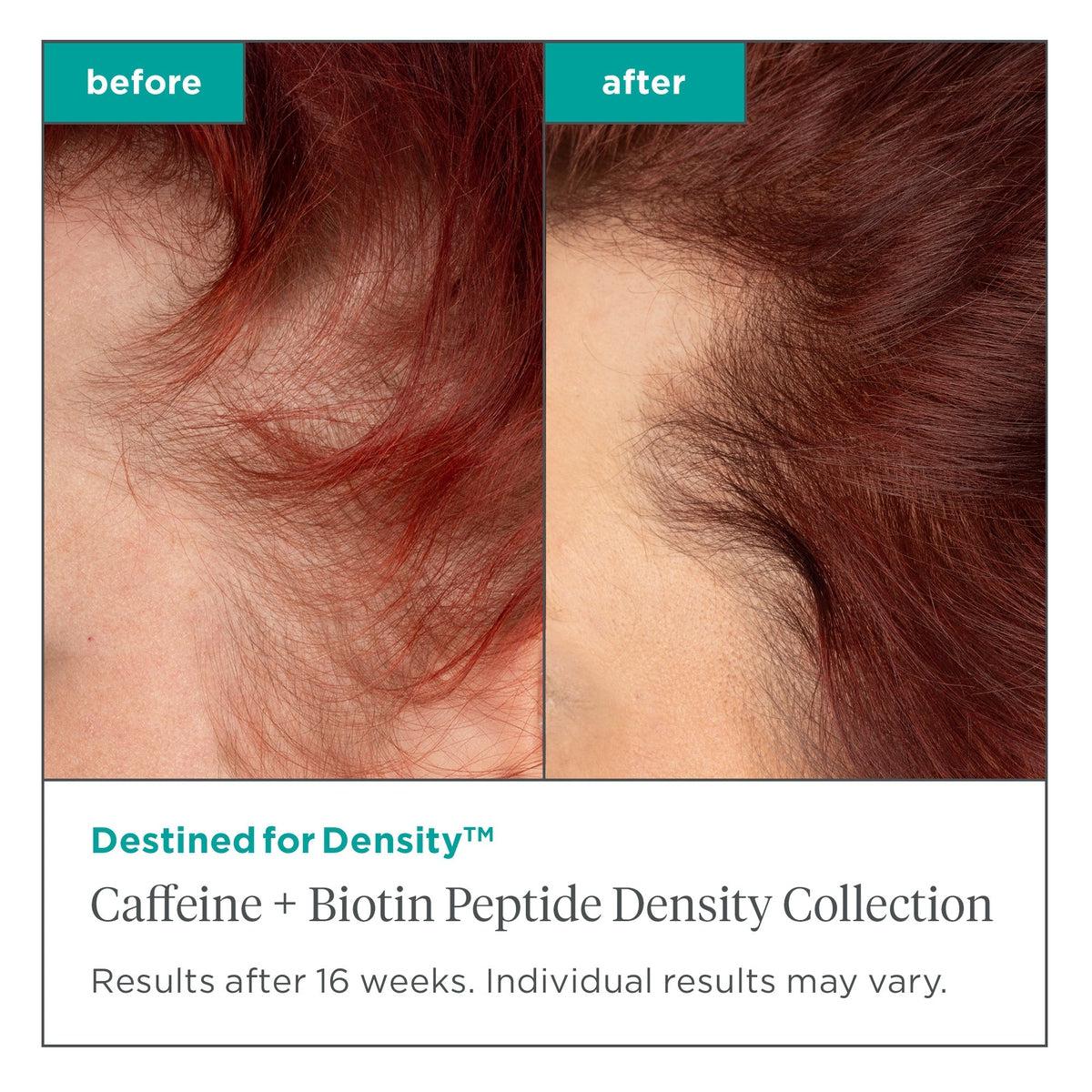 Destined For Density Caffeine & Biotin Peptide Hair Growth Conditioner - Thickening Treatment for Thinning Hair - Promotes Volume & Density for Men & Women - Perfect for Daily Hair Care Routine