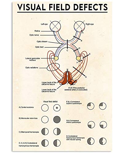 Visual Field Defects