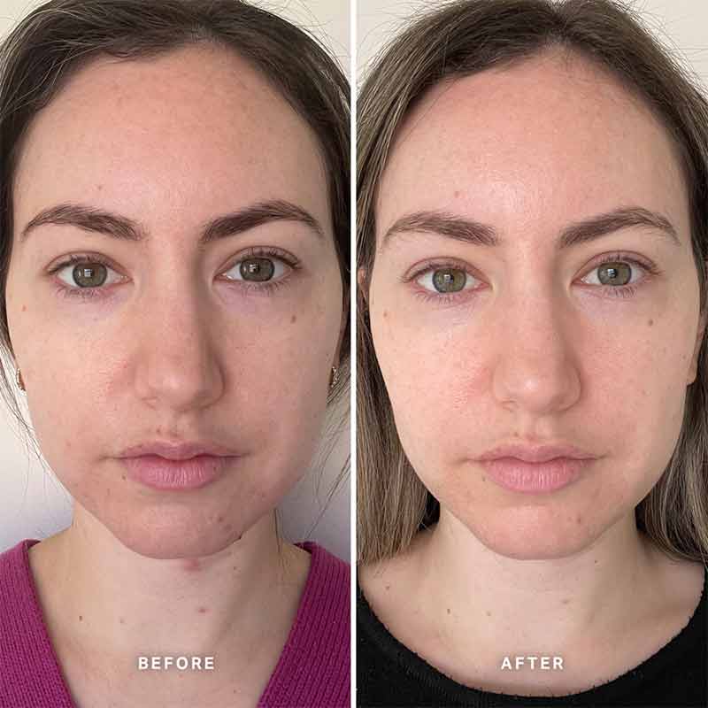 Alpha H Vitamin B Serum with 5% Niacinamide - Brightening & Hydrating Face Serum for Glowing Skin - Perfect for Daily Skincare Routine & Anti-Aging Care