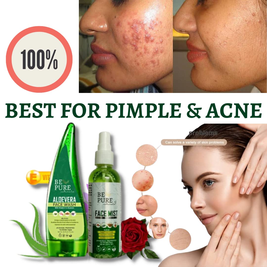 Pimple & Acne Removal Kit - Aloe Vera Face Wash with Vitamin E & Tea Tree Face Mist (120ml+100ml) for Clear Skin | Daily Acne Treatment for Oily & Sensitive Skin | Face Care Combo for Teens & Adults