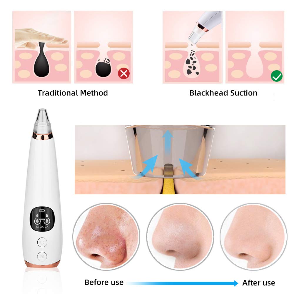 ATOMUS Electric Blackhead Remover Vacuum Tool - Professional Facial Pore Cleaner for Acne & Black Spots Removal - Skin Care Deep Cleaning Machine Kit for Home Spa & Beauty Routine