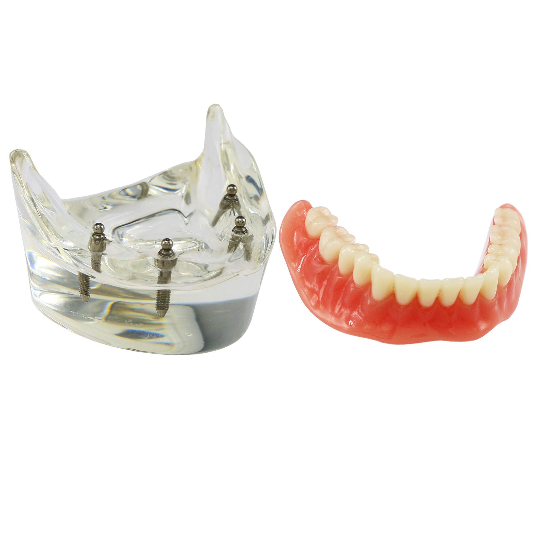 Dental Implant Teeth Model M6003 - Typodont Overdenture with 4 Implants for Lower Jaw Restoration | Dental Teaching & Study Demo | Perfect for Dental Students, Professionals & Clinical Practice