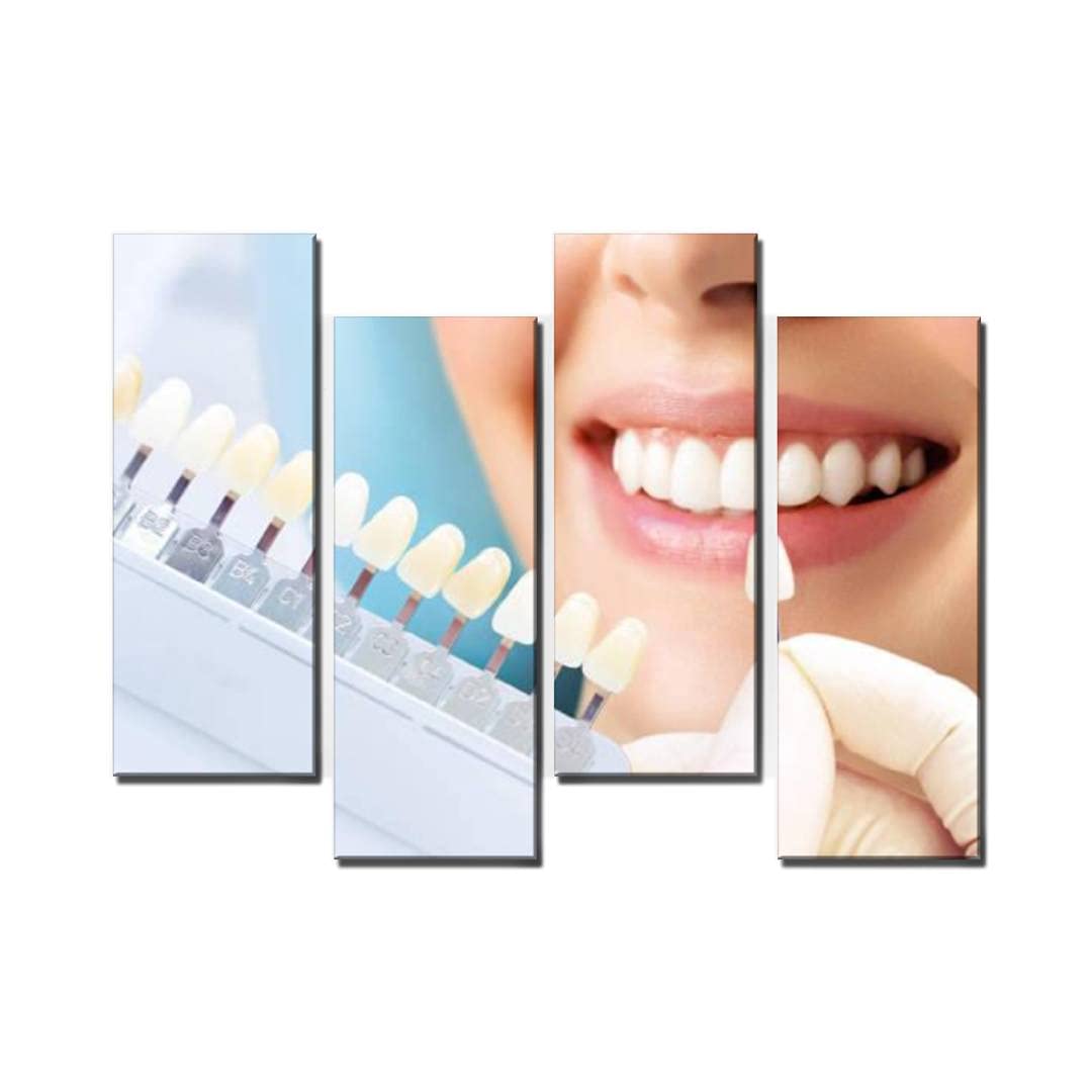 Wocatton Smiling Young Woman Teeth Whitening Dental Clinic Wall Art - Canvas Print Framed Decor for Living Room, Bedroom & Office