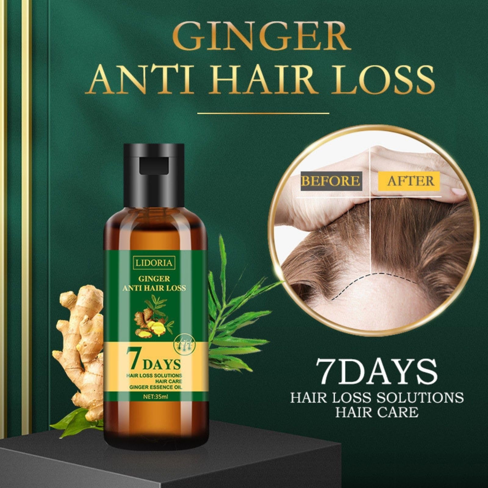 2PCS Lidoria Ginger Anti Hair Loss Oil - Natural Hair Growth Serum for Thicker, Stronger Hair - Nourishes Hair Roots & Scalp - Perfect for Daily Hair Care & Scalp Massage