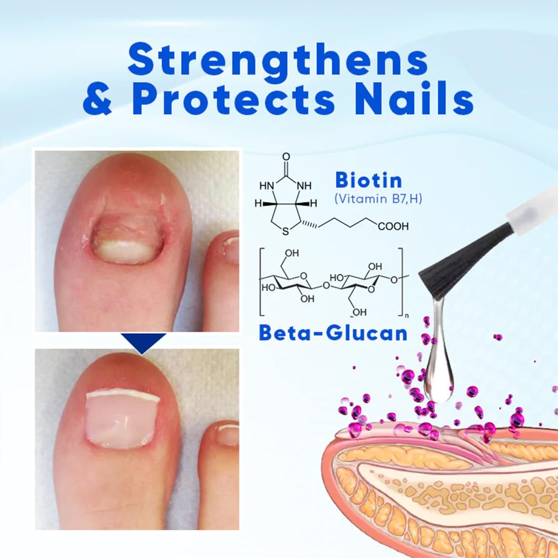 OnyxoGuard Nail Growth & Repair Serum - Strengthens Thin, Brittle & Damaged Nails - Crystal Clear Nail Strengthener Base Coat Treatment (1PC) - Perfect for Weak Nails, Manicures & At-Home Nail Care