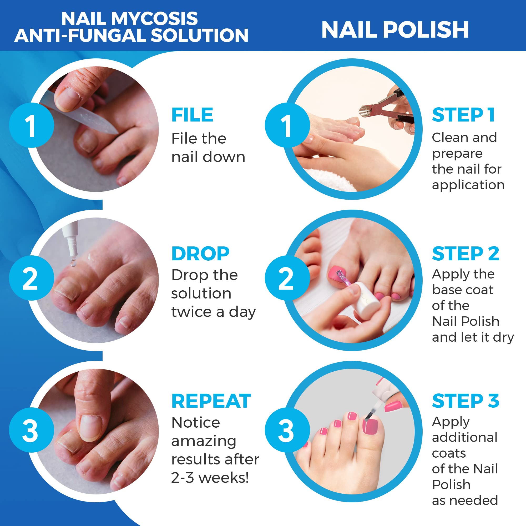 Best Nail Fungus Treatment with Pink Polish - Fast-Acting Antifungal Solution for Toenail & Fingernail Infections - Perfect for Salon Visits & At-Home Care