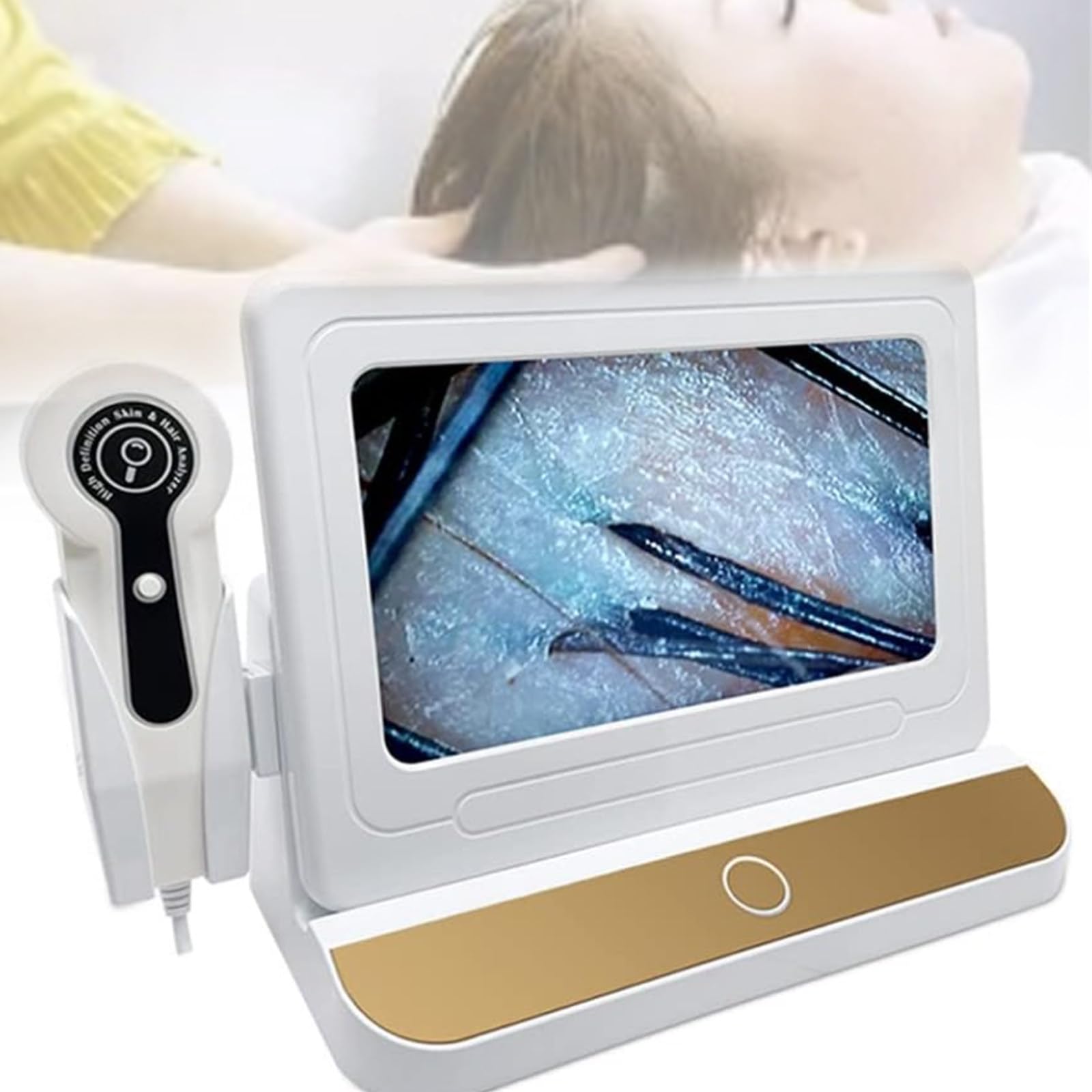 Professional HD Scalp & Hair Analyzer with 10