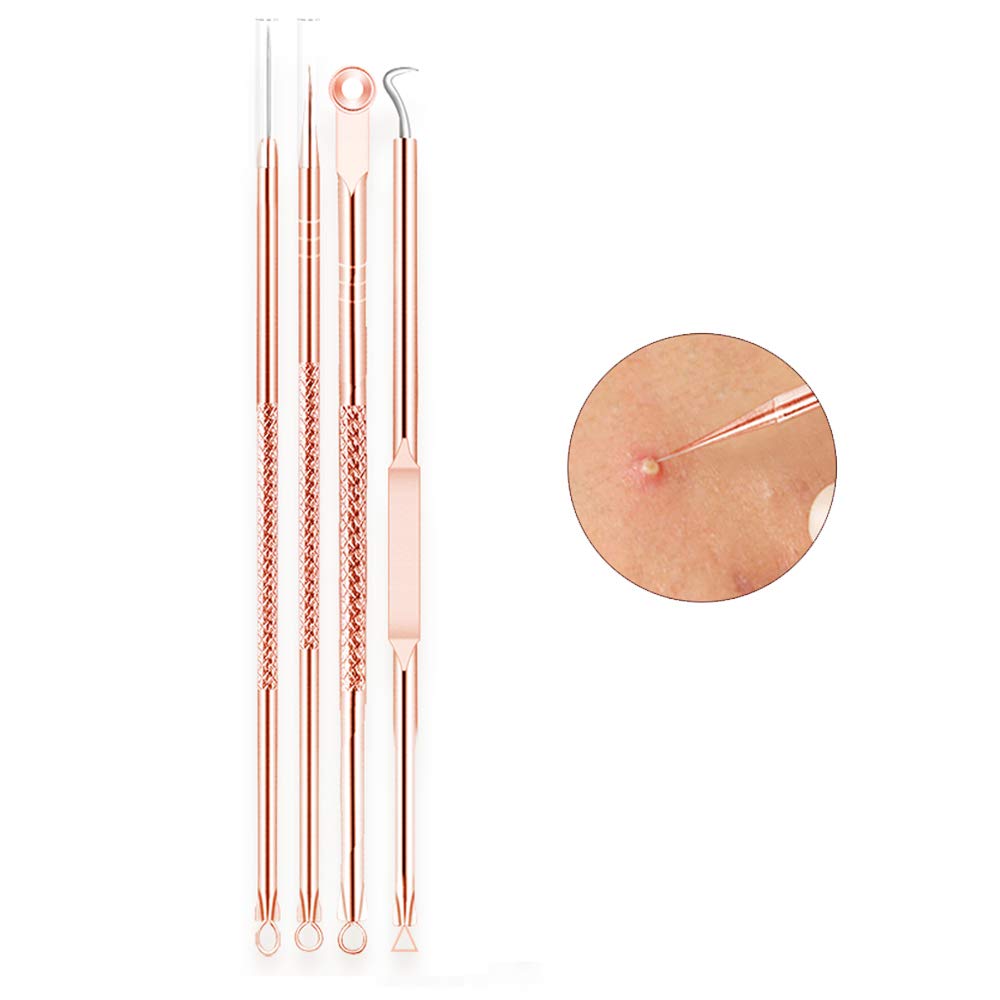 Professional 4-Piece Blackhead & Whitehead Remover Kit - Acne Pimple Extractor Tools Set with Comedone Blemish Removal (Rose Gold) for Clear Skin Care & Facial Treatment at Home