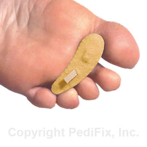 PediFix Hammer Toe Crest Cushion - Toe Straightener & Pain Relief for Hammertoes, Bunions & Corn - Comfortable Gel Pad for Daily Wear & Foot Support (Great for Walking, Running & Dress Shoes)