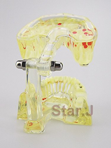 Dental Study Model - Transparent Adult Teeth Pathological Model for Dentists & Students | Perfect for Dental Education, Training & Practice