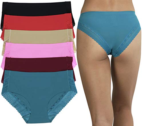Bikini Lace Back Trim - Vibrant Assortment