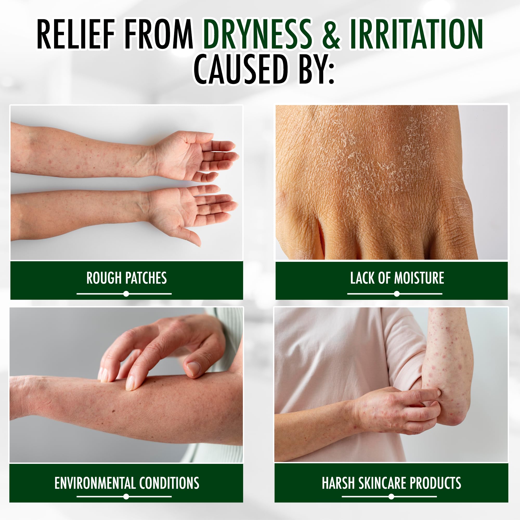 GLY MIRACLE Moisturizing Body Cream - 2oz Non-Greasy Hydrating Lotion for Extremely Dry Skin, Hands, Feet & Body | Fragrance-Free with Pure Glycerin | Deep Moisture for Cracked Heels, Rough Elbows & Winter Skin Care