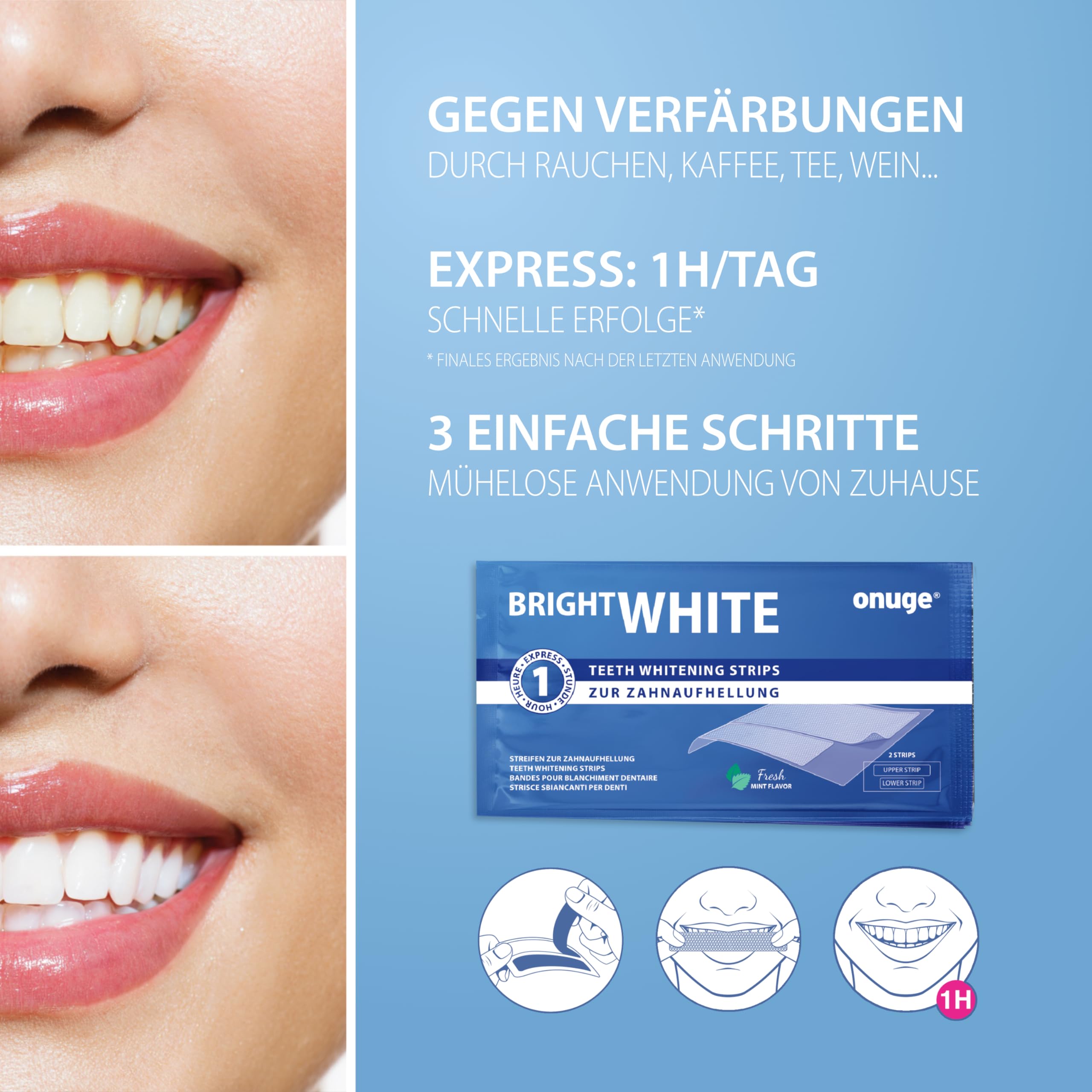 Onuge Bright White Teeth Whitening Strips - Peroxide-Free for Sensitive Teeth - 28 Strips (14 Day Treatment) - Professional Dental Care for Home Use - Perfect for Weddings, Job Interviews & Special Occasions