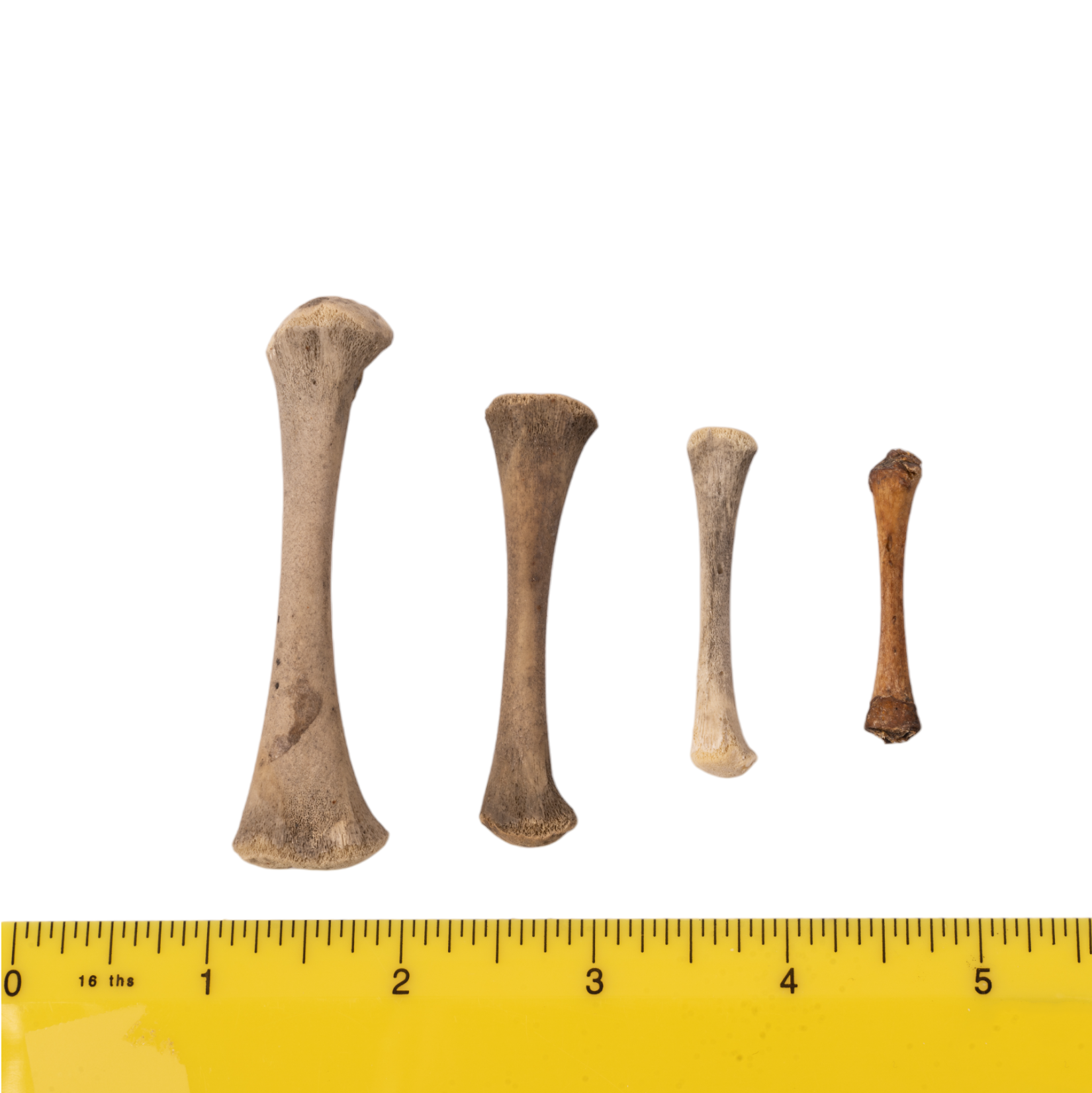 High-Quality Human Fetal Femur Bone Specimen for Medical Research & Education - Ideal for Anatomy Studies, Pathology Labs, and Forensic Science Applications
