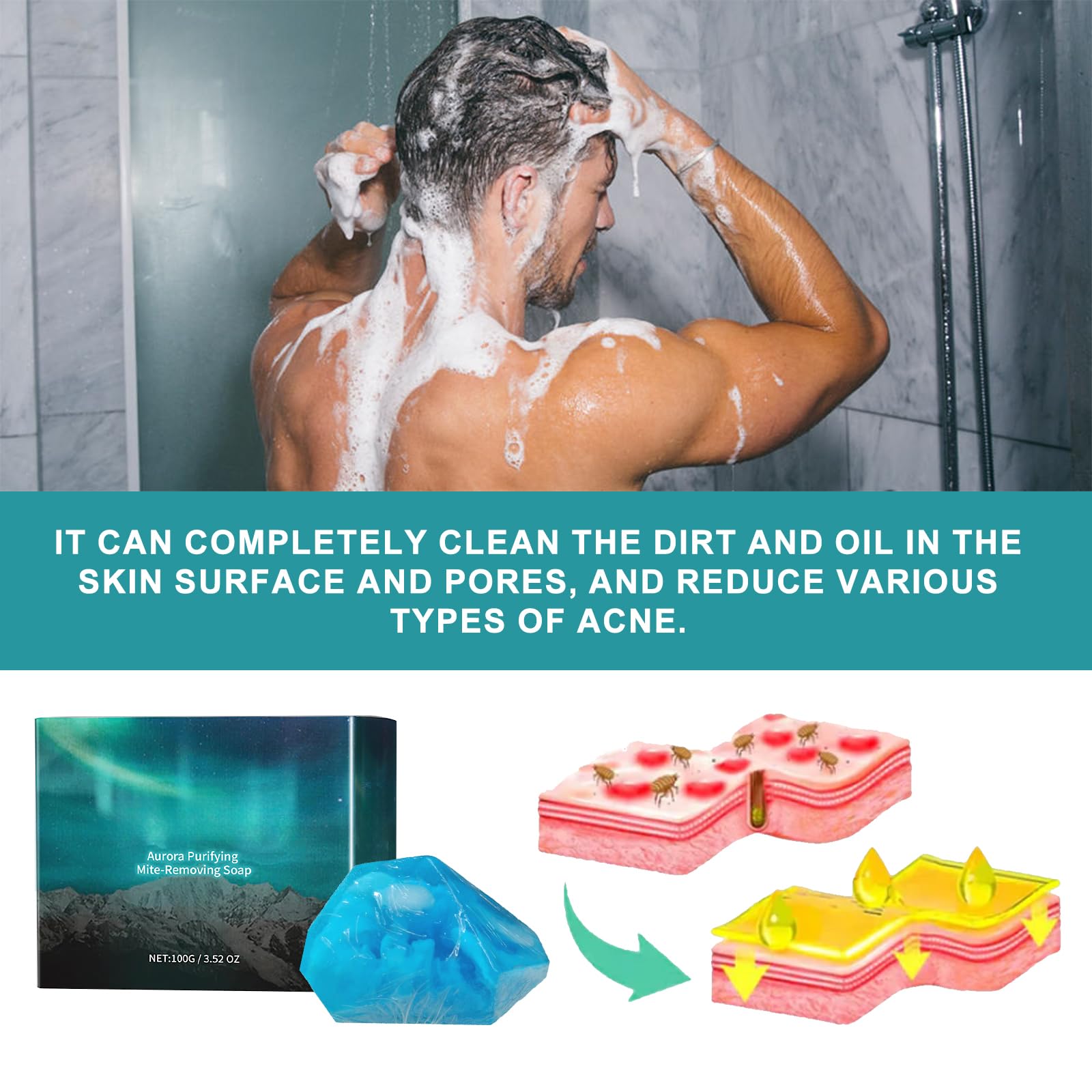 **Lisade Aurora Purifying Soap with Salicylic Acid - Acne Treatment, Oil Control & Moisturizing Body Wash - Lightens Acne Marks & Refreshes Skin - 2PCS - Perfect for Daily Cleansing & Post-Workout Skincare**