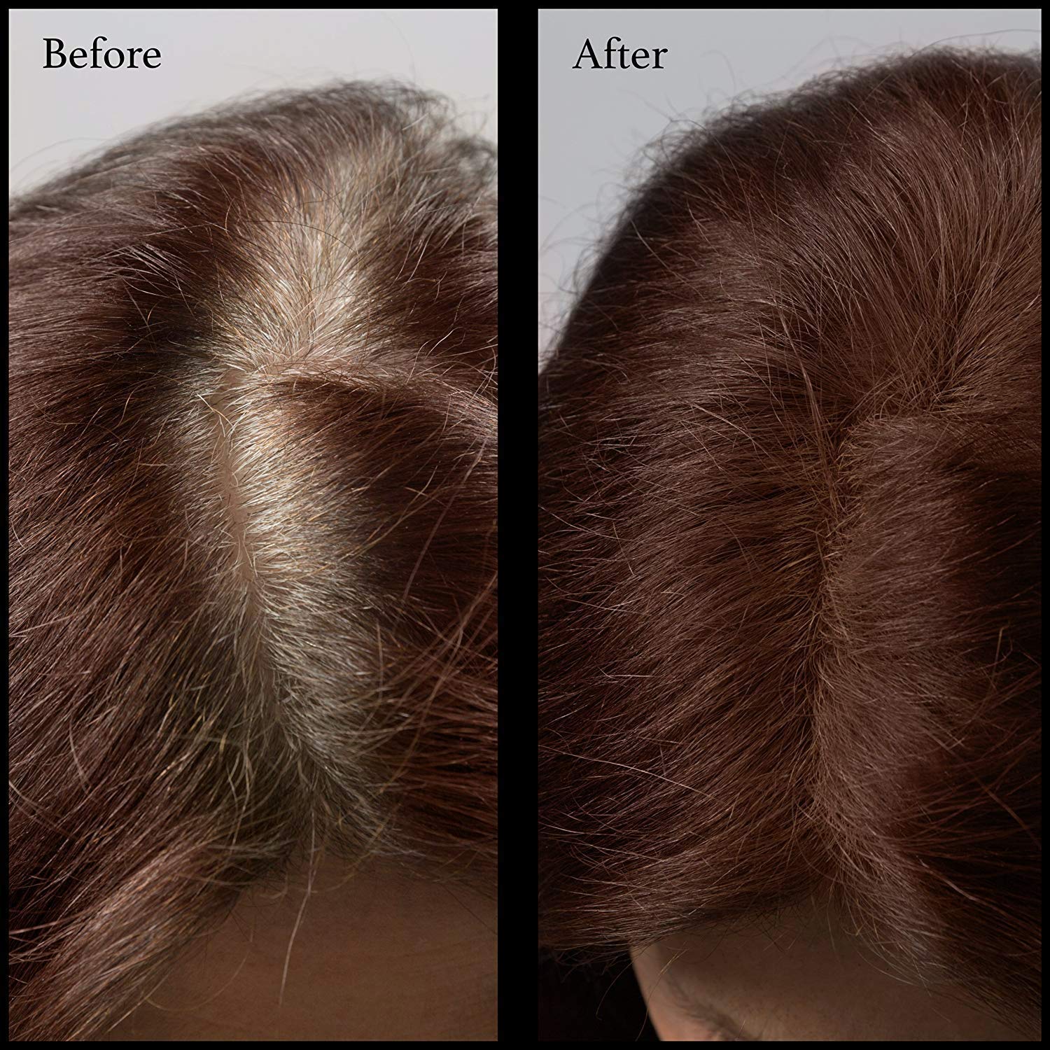 NuBeauti Root Touch Up Hair Powder - 11 Natural Shades, Fragrance-Free & Talc-Free Hairline Concealer (Dark Auburn) - Covers Gray Hair & Thinning Areas for Instant Volume & Confidence Boost