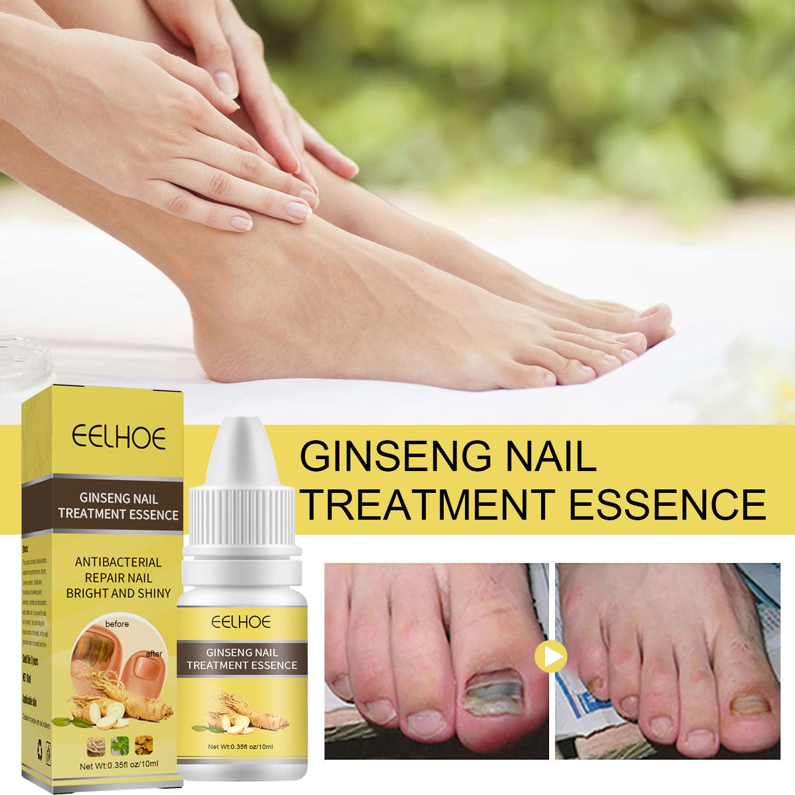 10ml Ginseng Nail Treatment - Herbal Hand & Foot Whitening Cream for Cracked, Rough, Brittle Nails - Natural Nail Care Solution for Toe & Finger Nails - Perfect for Pedicures, Manicures & At-Home Nail Care Routines