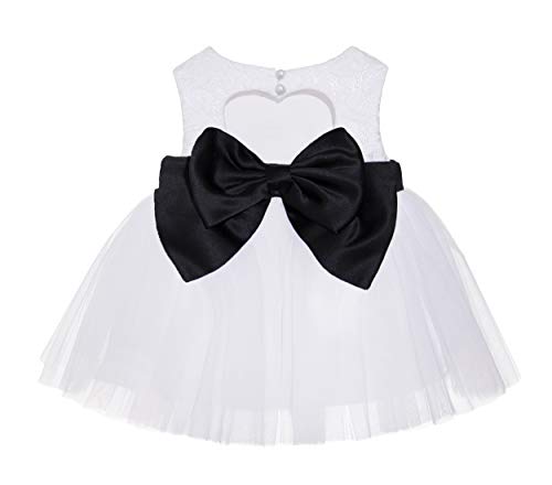 White / Black