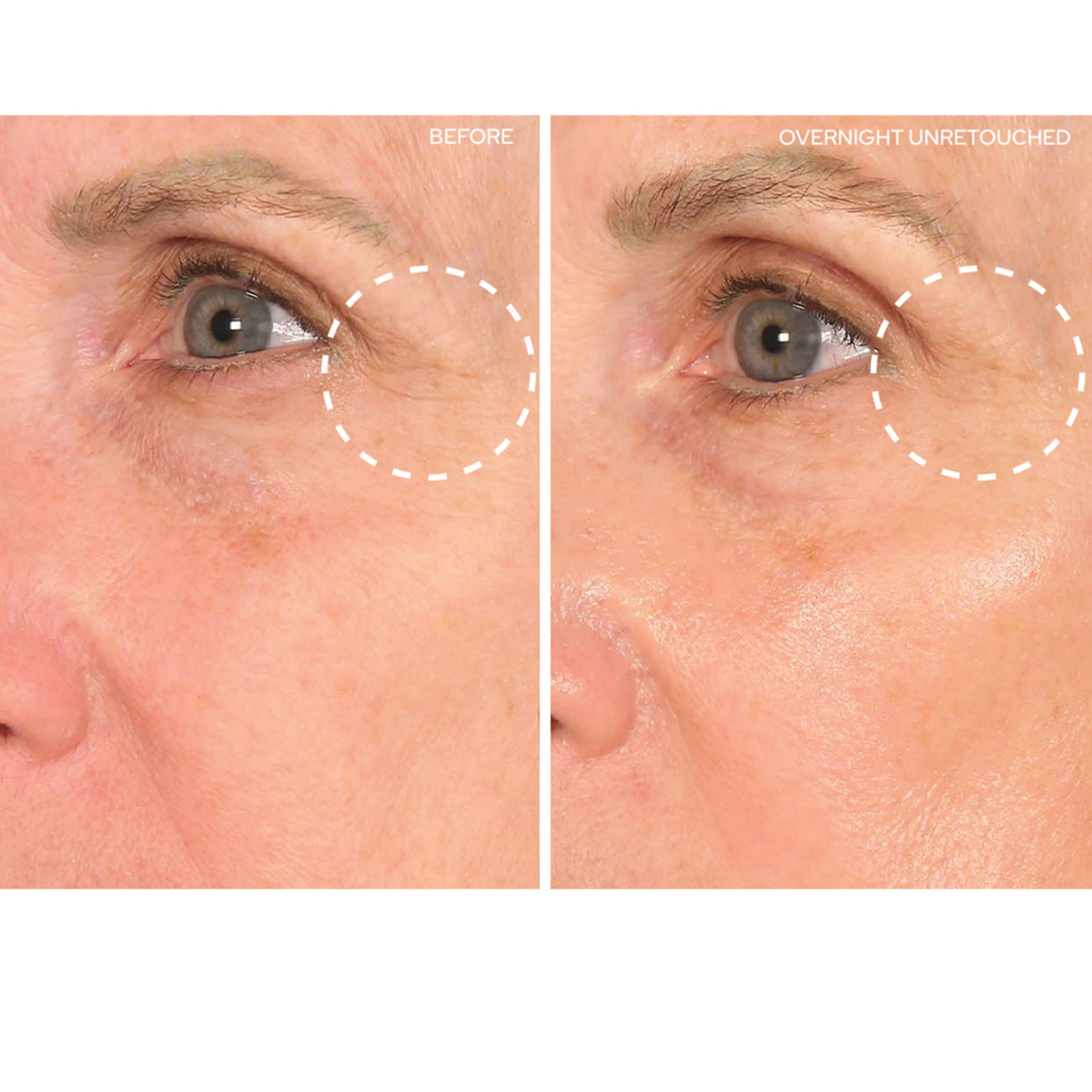 Eye and Smile Lift - Anti-Aging Facial Serum for Wrinkles & Fine Lines | Brighten Skin & Reduce Dark Circles | Perfect for Night Routine & Special Occasions