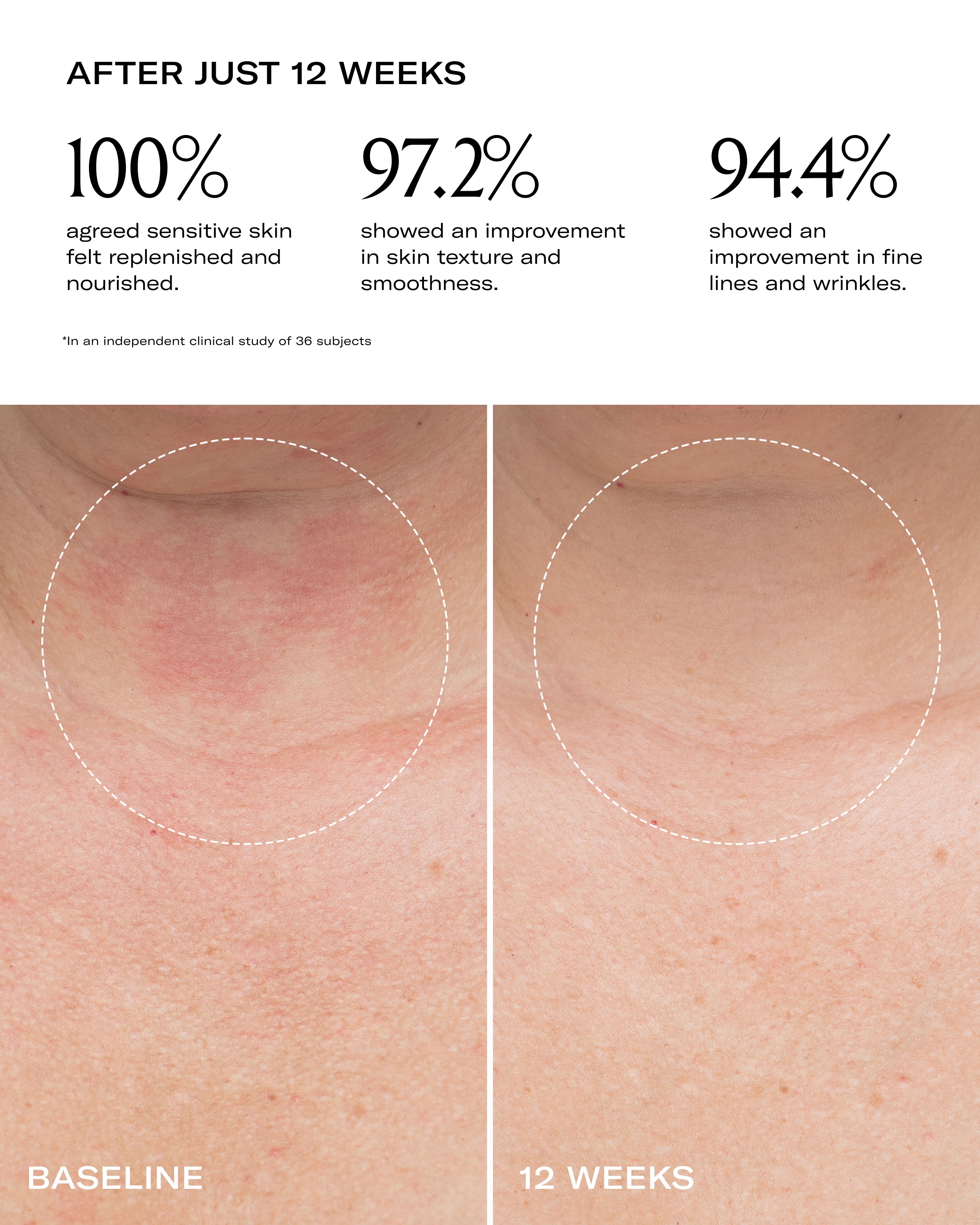 Le Prunier Plumbody Organic Face Oil - Hydrating & Anti-Aging Skincare for Dry Skin | Perfect for Night Routine & Travel Skincare