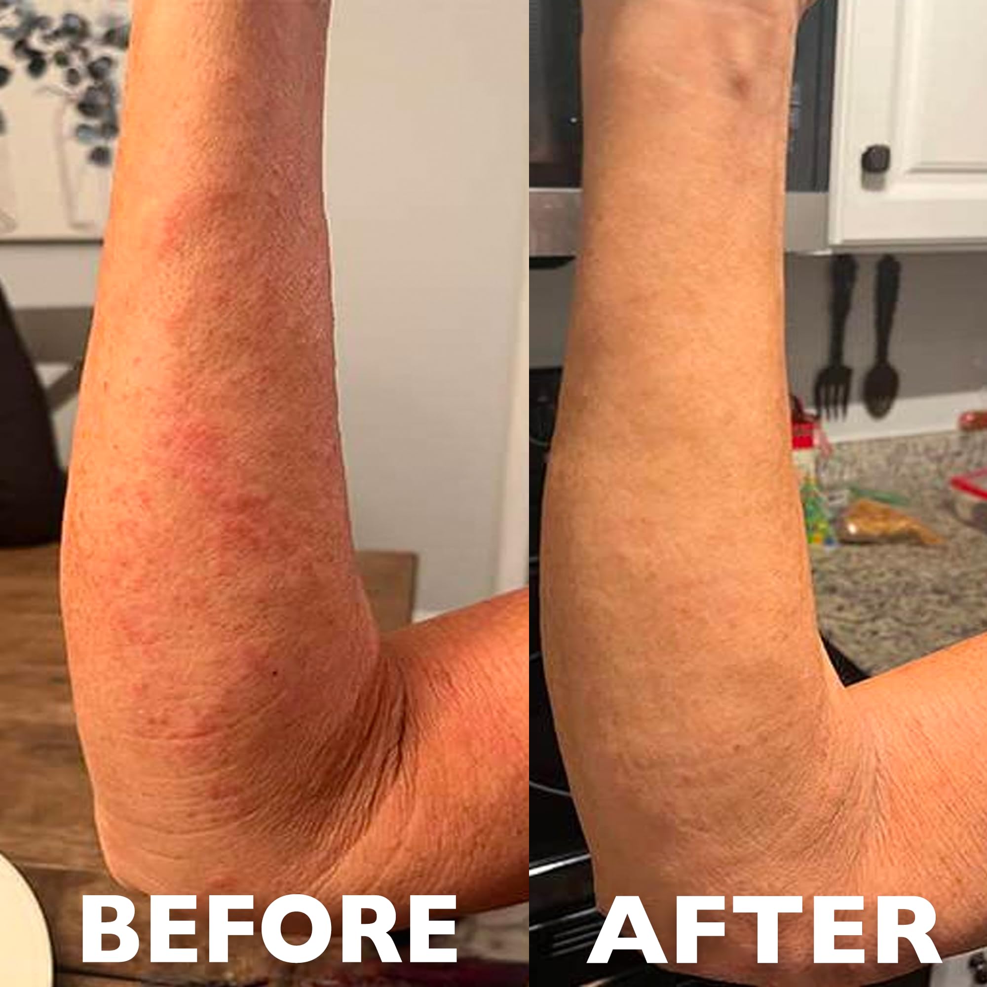 Healing Ointment for Burns & Skin Irritation - Organic Honey & Propolis - 99% Natural - Soothes Dry Skin Fast