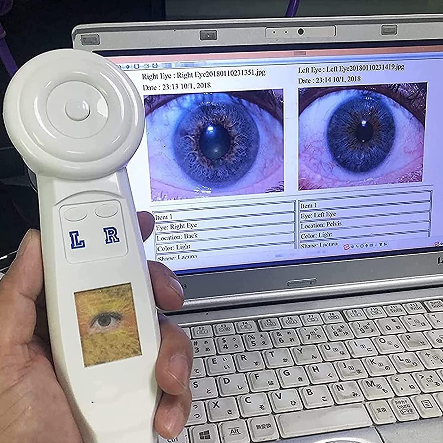 GEHPYYDS 5MP Iridology Camera - 2560x1920 Resolution, USB 2.0 Iris Analysis System with 30x HD Lens for Eye Health Diagnosis | Computer Analyzer for Naturopathic Doctors & Holistic Practitioners | Perfect for Eye Exams, Iridology Research & Alternative Medicine Practices