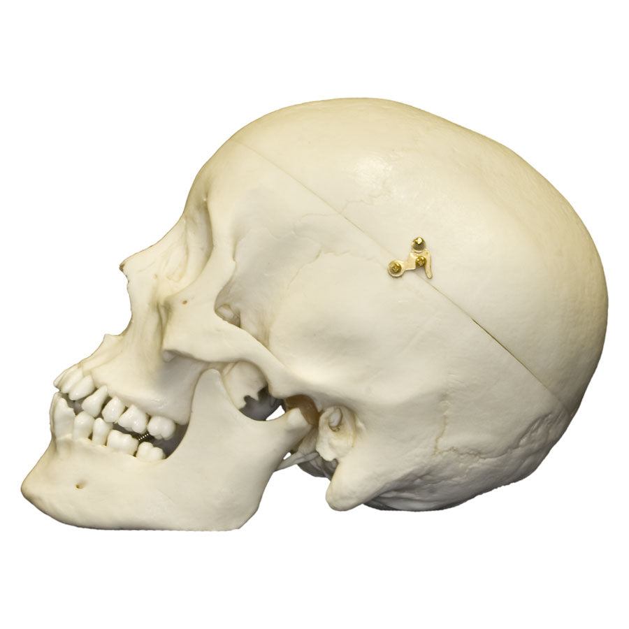 Authentic Replica Human Male Adolescent Skull with Calvarium Cut - Anatomical Model for Medical Education, Science Classrooms & Halloween Decor