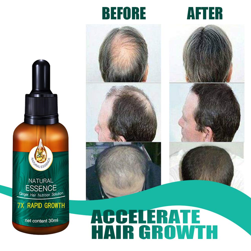 7X Fast Hair Growth Serum - Ginger & Germinal Oil Treatment for Thicker Hair & Anti Hair Loss - Promotes Regrowth for Men & Women (2Pcs) - Perfect for Daily Use, Hair Repair & Scalp Care