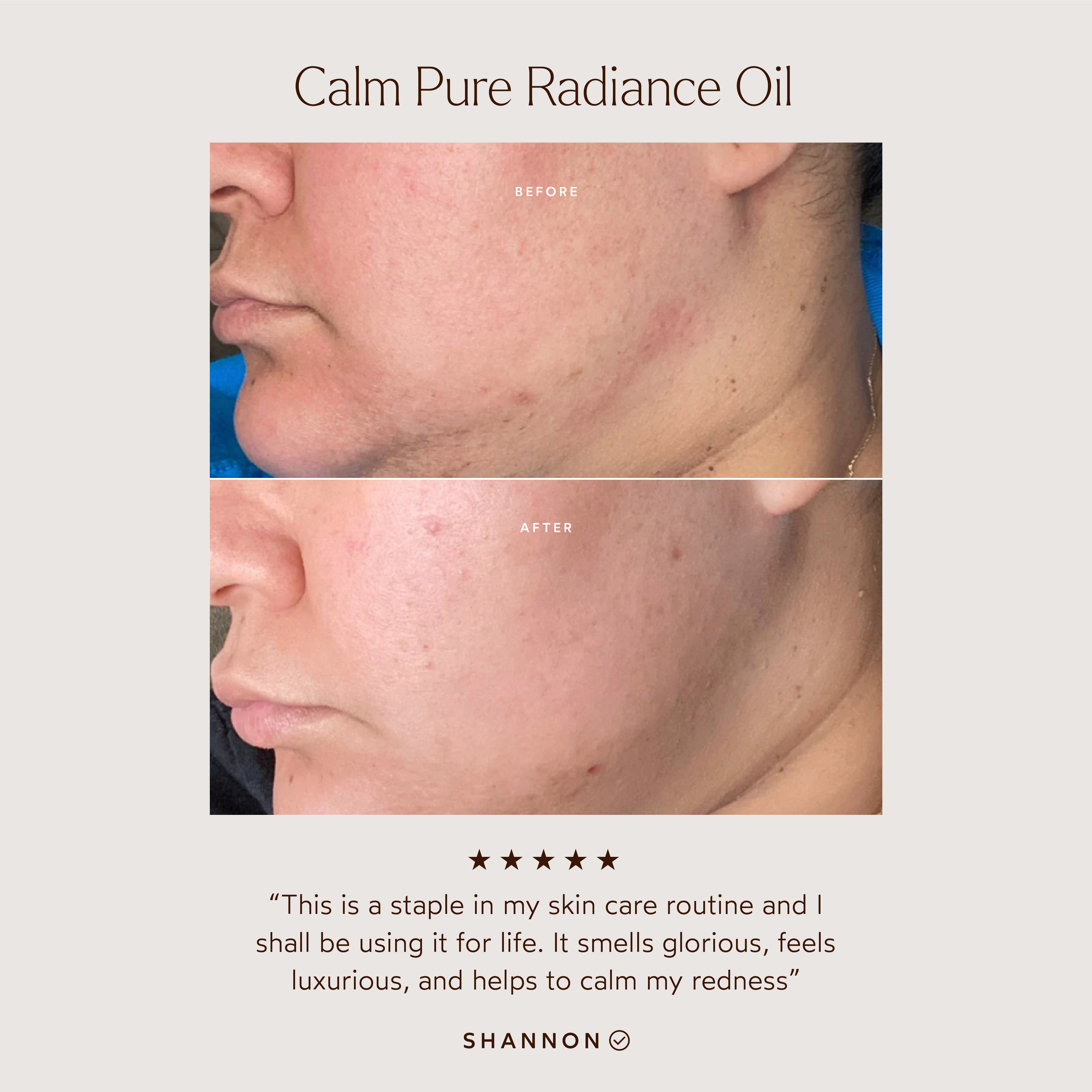 CALM Pure Radiance Oil - Organic Facial Oil for Glowing Skin, Hydration & Anti-Aging | Perfect for Night Routine, Dry Skin Care & Daily Moisturizing
