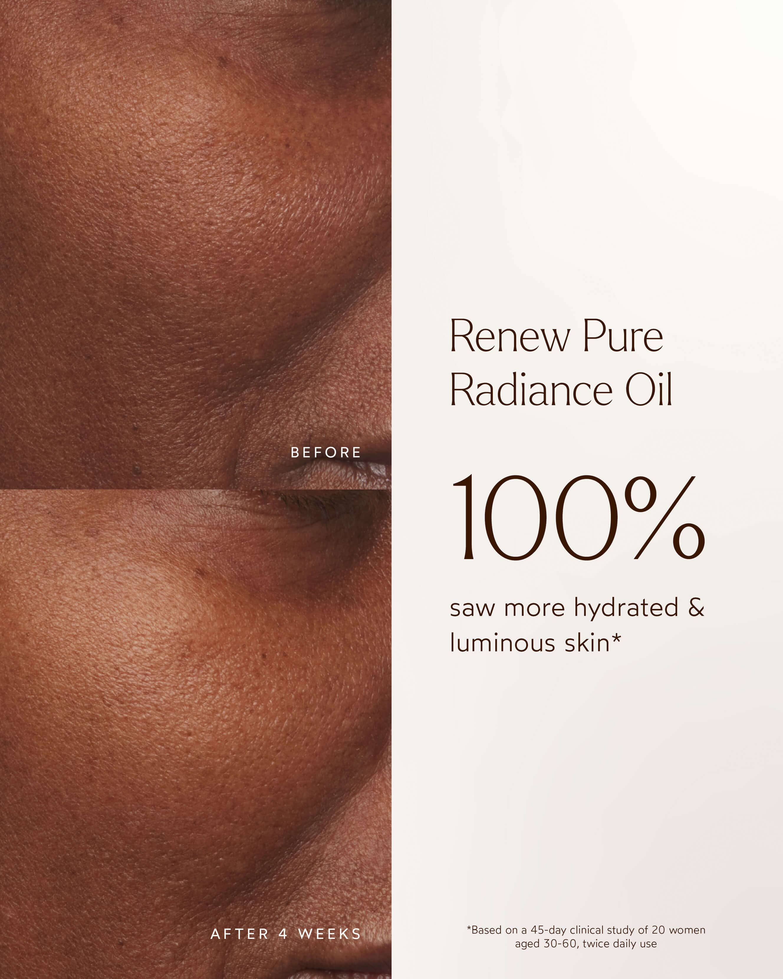 Renew Pure Radiance Hydrating Oil for Face & Body - Organic Moisturizing Treatment for Dry Skin - Perfect for Nighttime Skincare & Massage Therapy