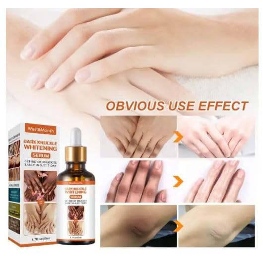 67 Stores Advanced Dark Knuckle Whitening Serum - Skin Tone Corrector for Hands & Elbows | Brightening & Moisturizing Treatment for Women & Men | 30ml | Perfect for Dry, Rough Skin & Hyperpigmentation Care