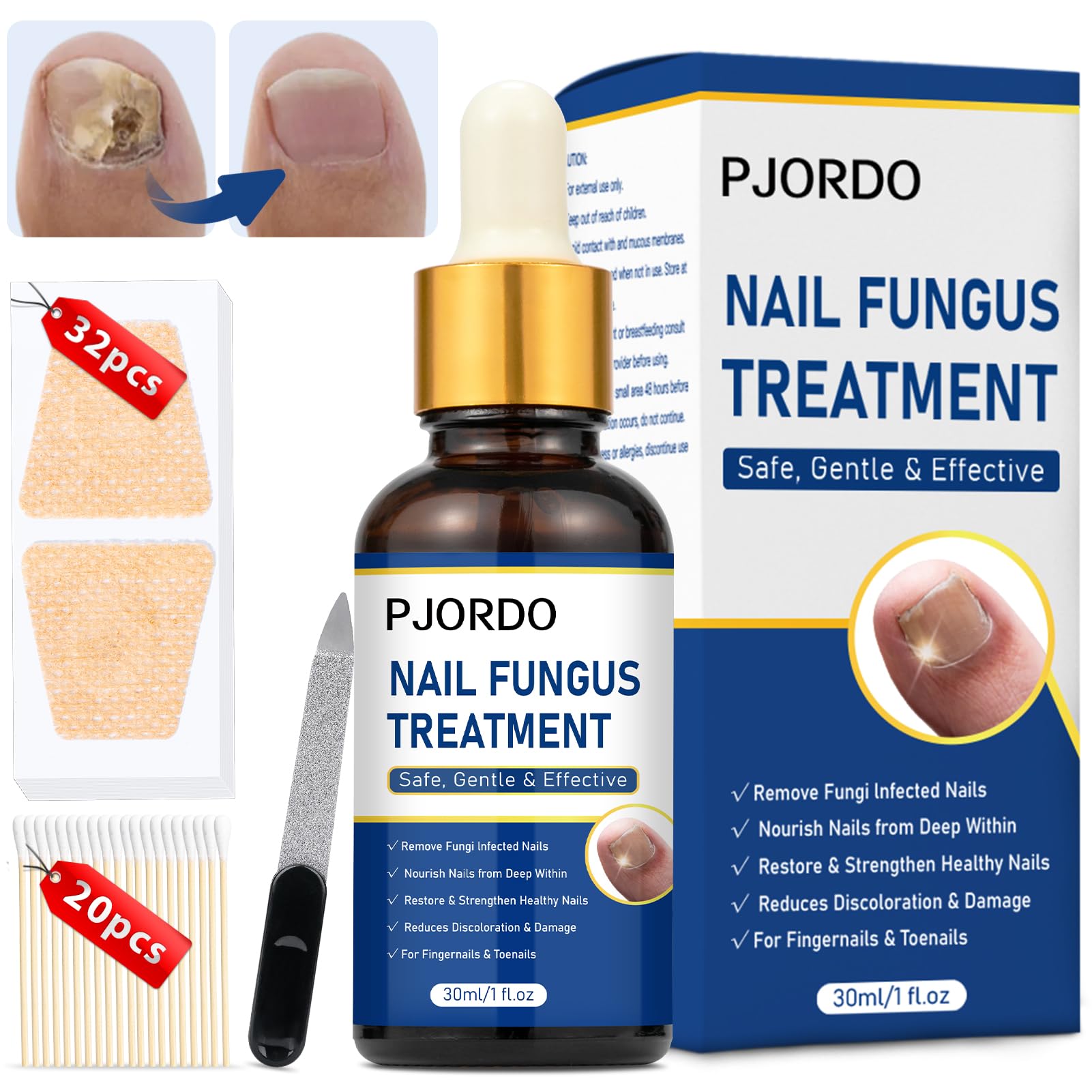 Extra Strength Toenail Repair Treatment with 32 Nail Patches - Fungal Nail Solution for Toenails & Fingernails - Fixes Athlete's Foot, Thickened & Discolored Nails - Ideal for Gym, Pool & Sports Locker Rooms