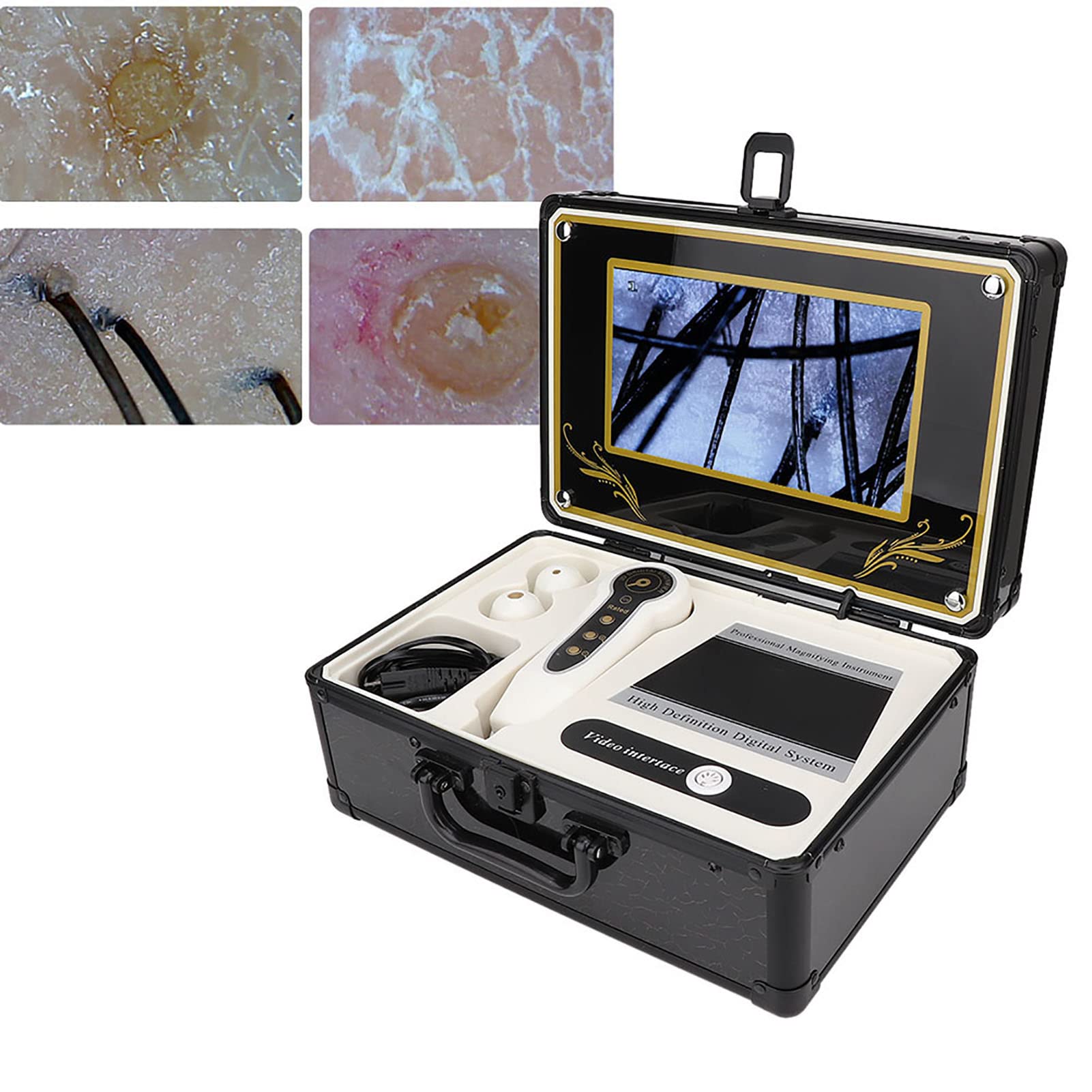 50X-200X Skin & Hair Analyzer Microscope - Professional Scalp Detector for Hair Follicle & Oil Analysis | Skin Care Diagnostic Tool with Magnifying Lens (US Plug) | Perfect for Home Hair Care & Dermatology Checkups