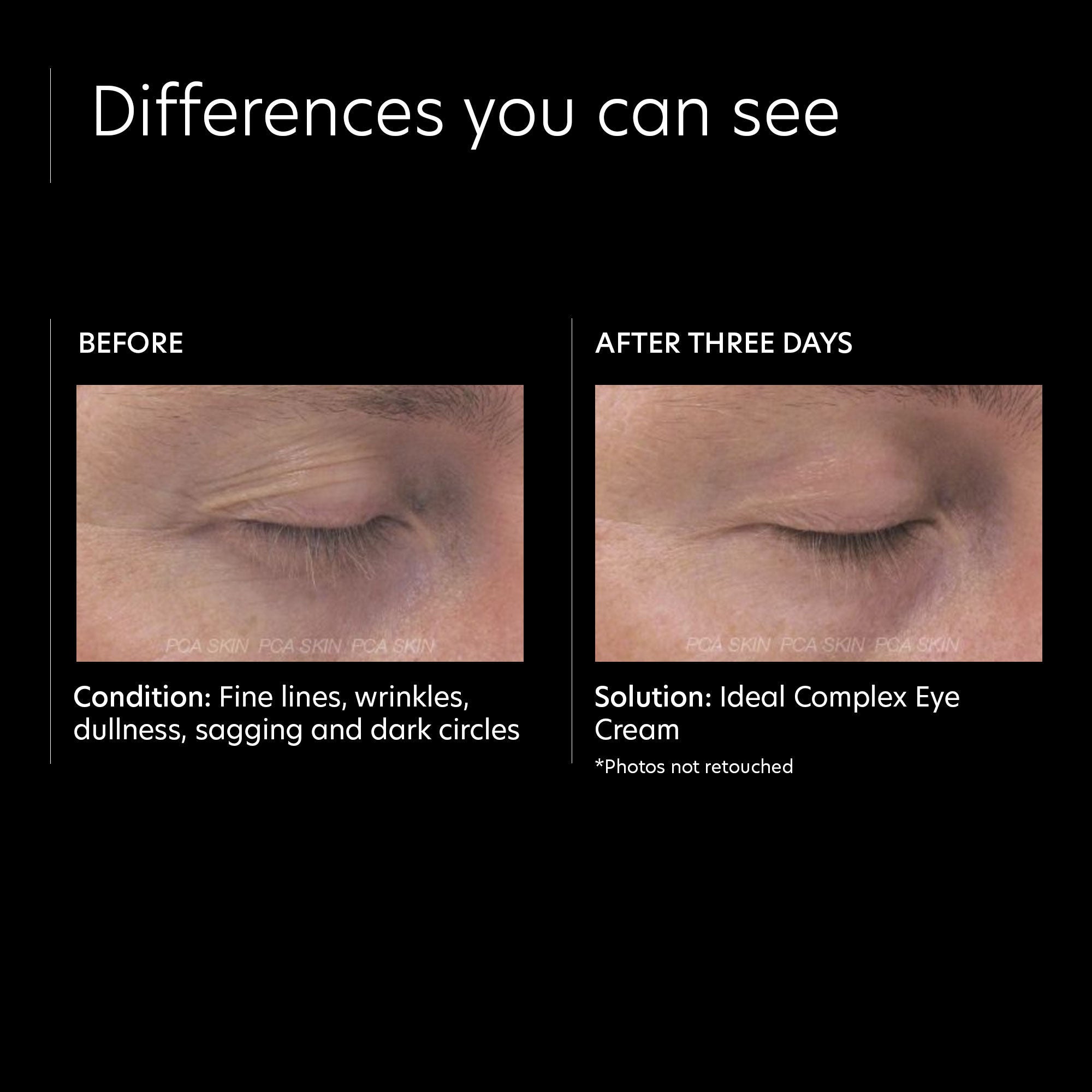 Ideal Complex Restorative Eye Cream for Dark Circles, Wrinkles & Puffiness – Anti-Aging Treatment for Men & Women – Perfect for Night & Day Use