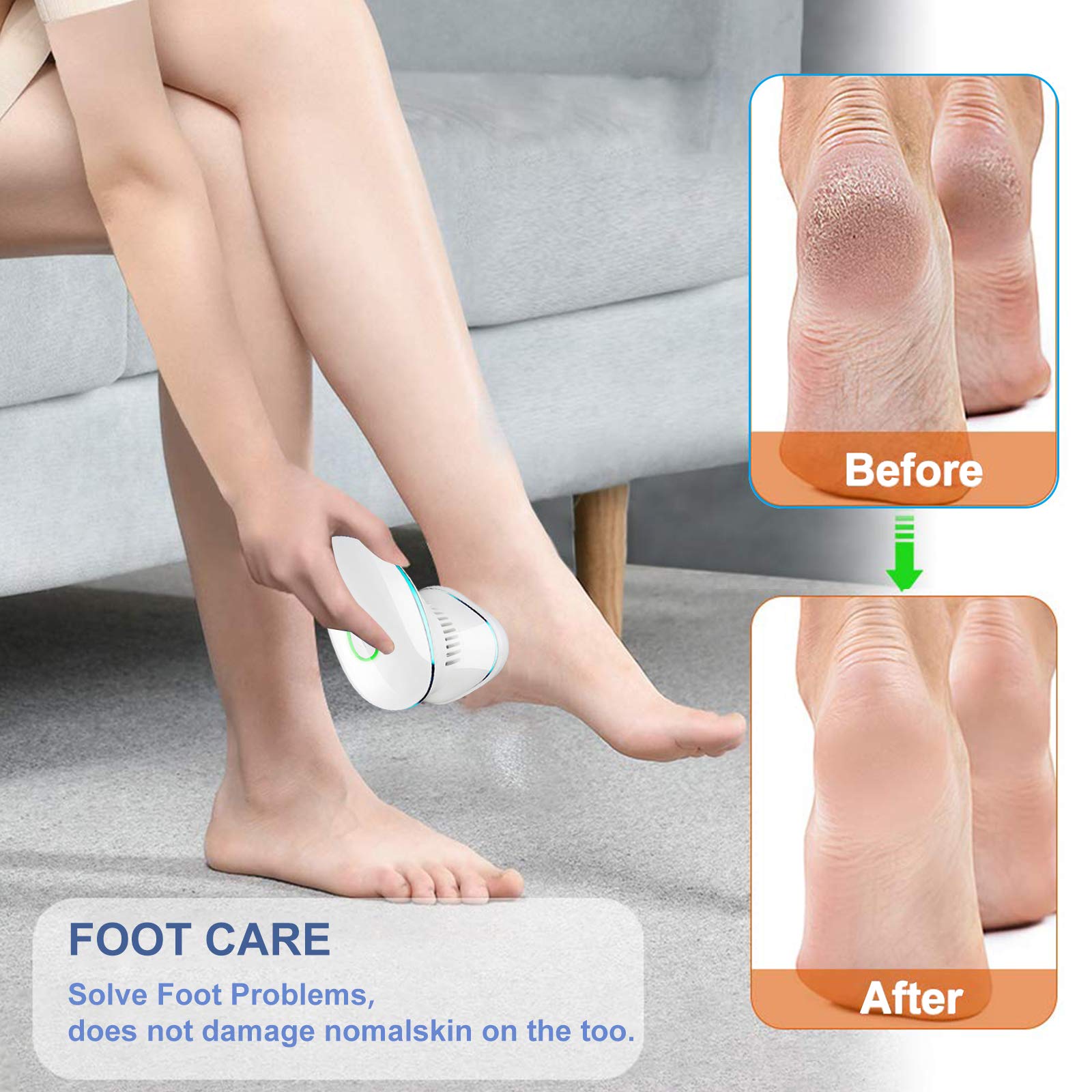 Electric Callus Remover for Feet - Rechargeable Pedicure Tool with Built-in Vacuum, Professional Foot File & Dead Skin Remover for Cracked Dry Heels - At Home Spa & Pedicure Care (Blue)